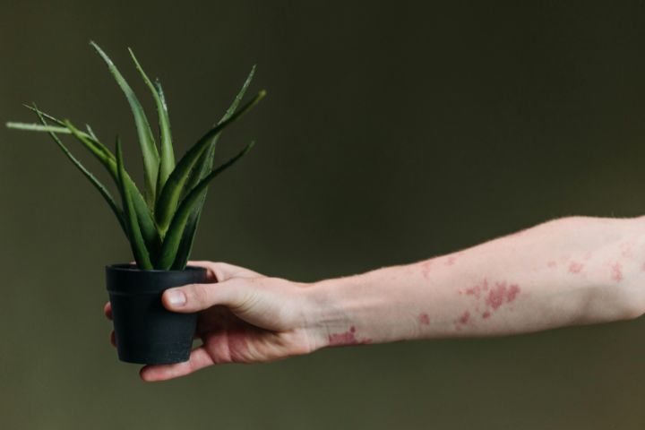 Rashes – Causes, Types, Symptoms, and Treatments